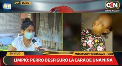 Niña de un año queda con rostro desfigurado tras ataque de can