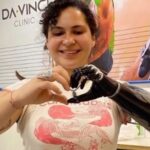 Renata Tiretta prueba innovadora prótesis biónica en Brasil