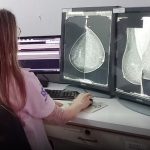 Nuevos mamógrafos impulsan detección temprana de cáncer