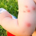 Consejos para evitar picaduras de mosquitos en niños